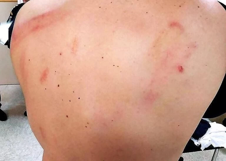 Σοκάρουν οι φωτογραφίες των αστυνομικών που τραυματίστηκαν στο συλλαλητήριο